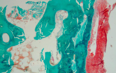 Bone histology workshop and FASE Symposium, PARIS, 28-30 August 2025
