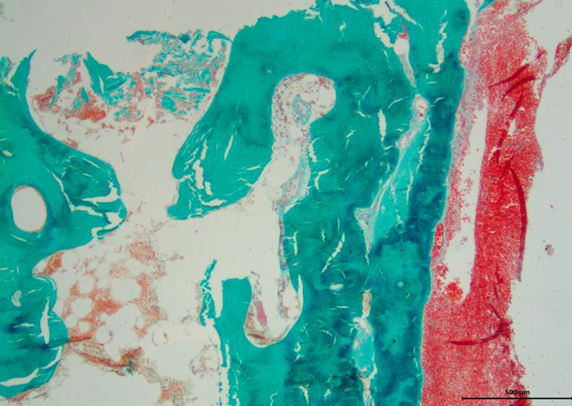 Bone histology workshop and FASE Symposium, PARIS, 28-30 August 2025